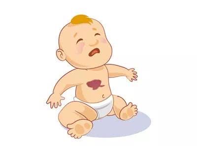 济南哪个医院治疗幼儿血管瘤比较好