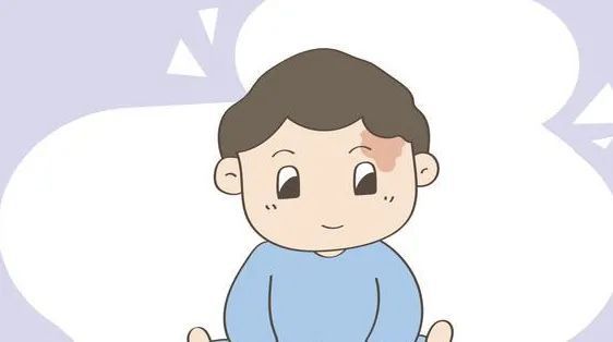 济南哪家医院治疗胎记比较好