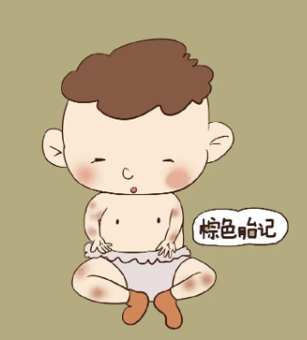 济南哪家医院看胎记好