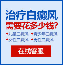 东莞白癜风比较好的医院是哪家？如何治疗白癜风省钱？