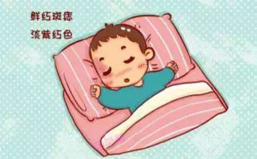济南鲜红斑痣哪里看的好