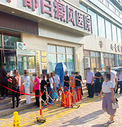 沧州白癜风医院?白癜风如何预防发病?