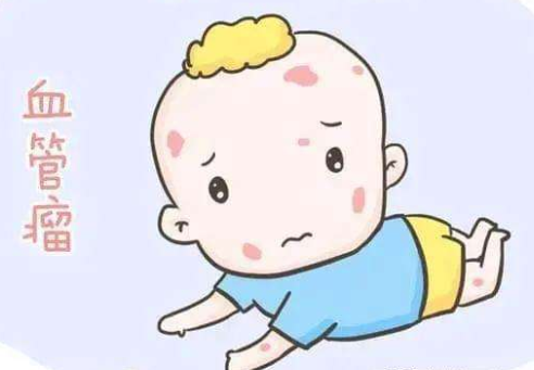 济南治疗婴儿血管瘤医院哪个比较好