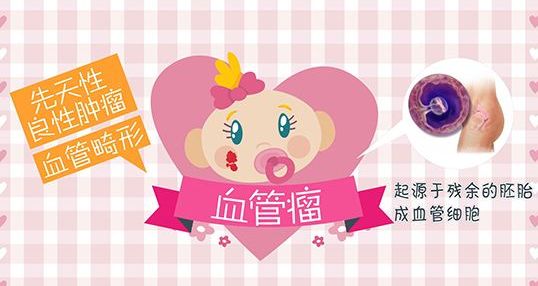 济南儿童医院治血管瘤怎么样