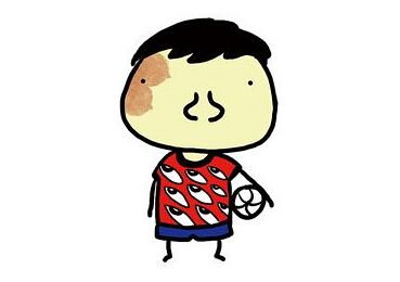 济南祛除婴幼儿血管瘤的医院哪家好