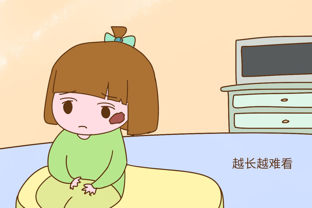 济南哪个医院祛胎记比较好