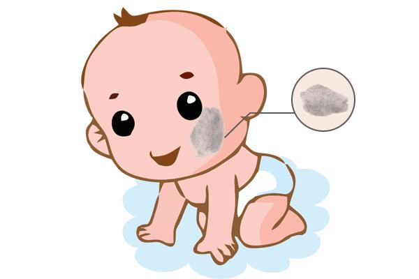 济南哪个医院看脸上胎记好？盲目治疗胎记有哪些不良影响呢？