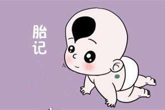 济南祛胎记的医院有哪些