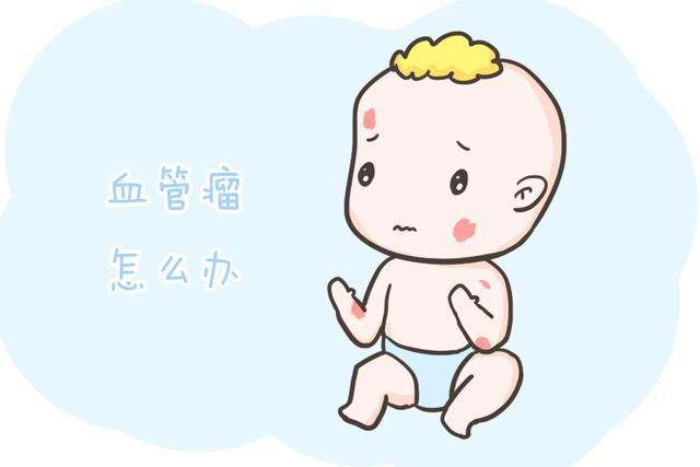 济南哪家医院治疗婴儿血管瘤好