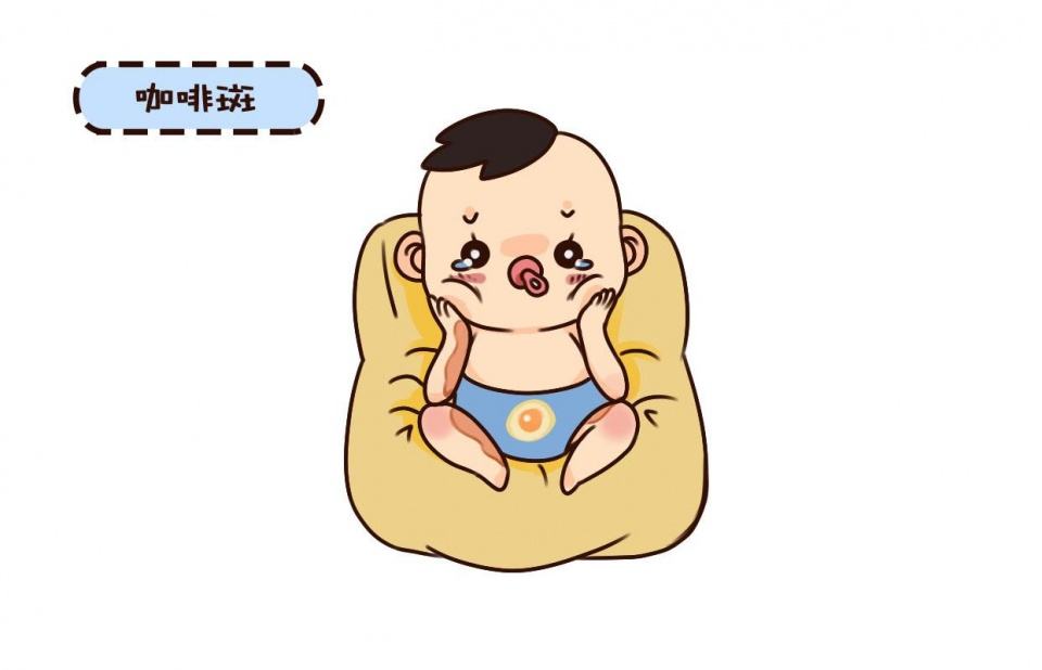 济南去除咖啡斑医院哪里好