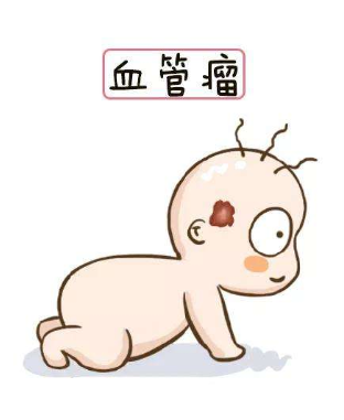 济南治疗孩子血管瘤哪家医院好？
