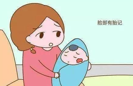 济南看婴幼儿胎记哪个医院好