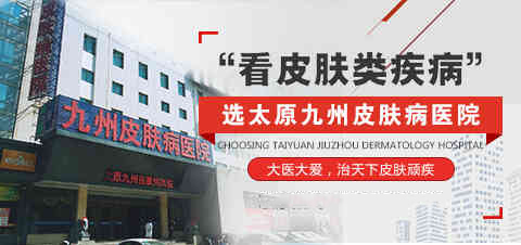 太原看皮肤病医院排名-黑痣可以采用什么方法治疗