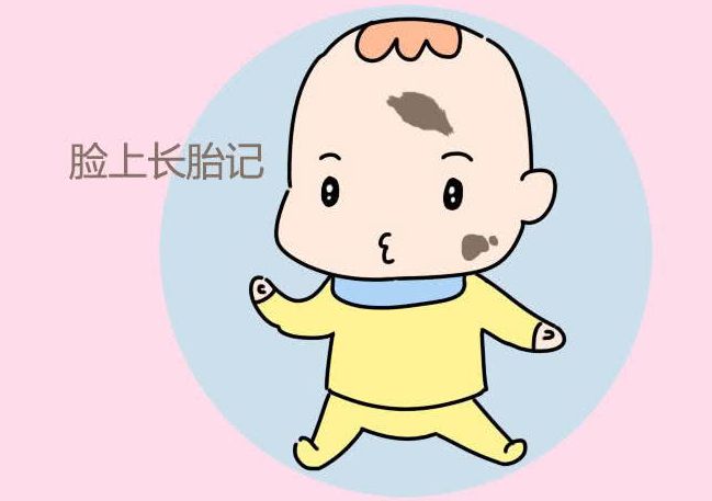 治疗胎记要趁早，快来济南童康儿童医院