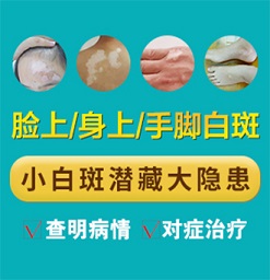 长安白癜风专科医院，白癜风如何--治疗？