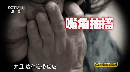 济南军颐医院王俊勇主任介绍：面肌痉挛如何预防及措施