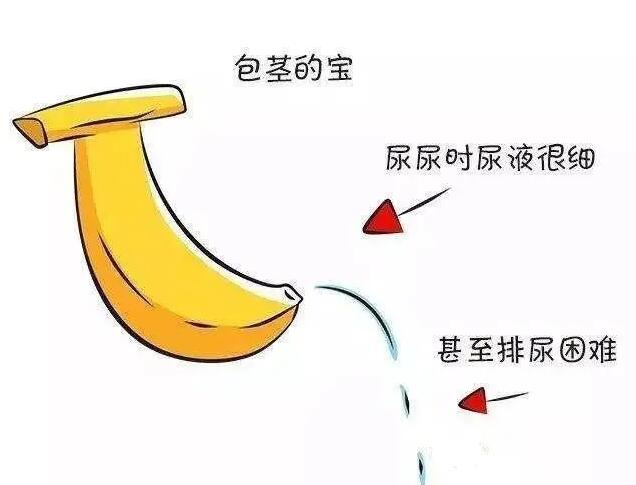 成都包茎治疗需要多少钱