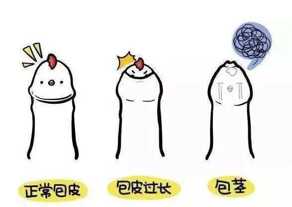 四川哪家医院割包皮好