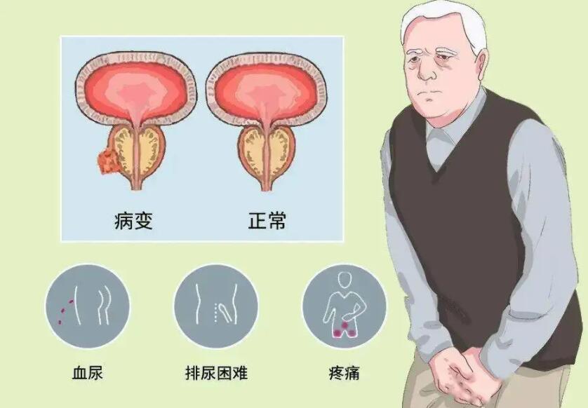 成都成华区男科医院排行