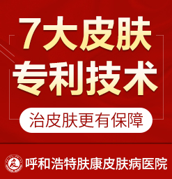 呼和浩特去哪个医院荨麻疹比较好_荨麻疹都有什么样的表现症状
