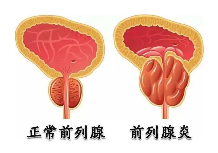 成都治疗男科病哪个医院好