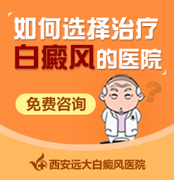 患上白斑在生活中要注意什么呢?西安白癜风哪家看的好