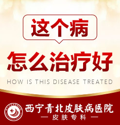 西宁治湿疹哪家医院好_西宁哪个医院治湿疹比较好