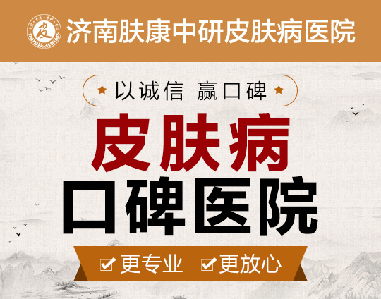 济南肤康中研皮肤科医院好不好_济南肤康中研中医院