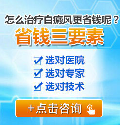福建省三明专业白癜风医院：白癜风的护理哪些是重点?