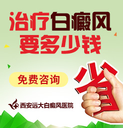 白癜风治疗恢复不好和哪些因素有关?陕西白癜风哪家好
