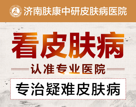 济南治皮肤病好的医院哪家好_济南皮肤医院哪家看的好