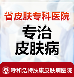 呼和浩特治疗过敏性皮炎的医院_哪个医院治湿疹较好呼市