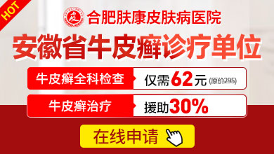 合肥膚康牛皮癬醫院